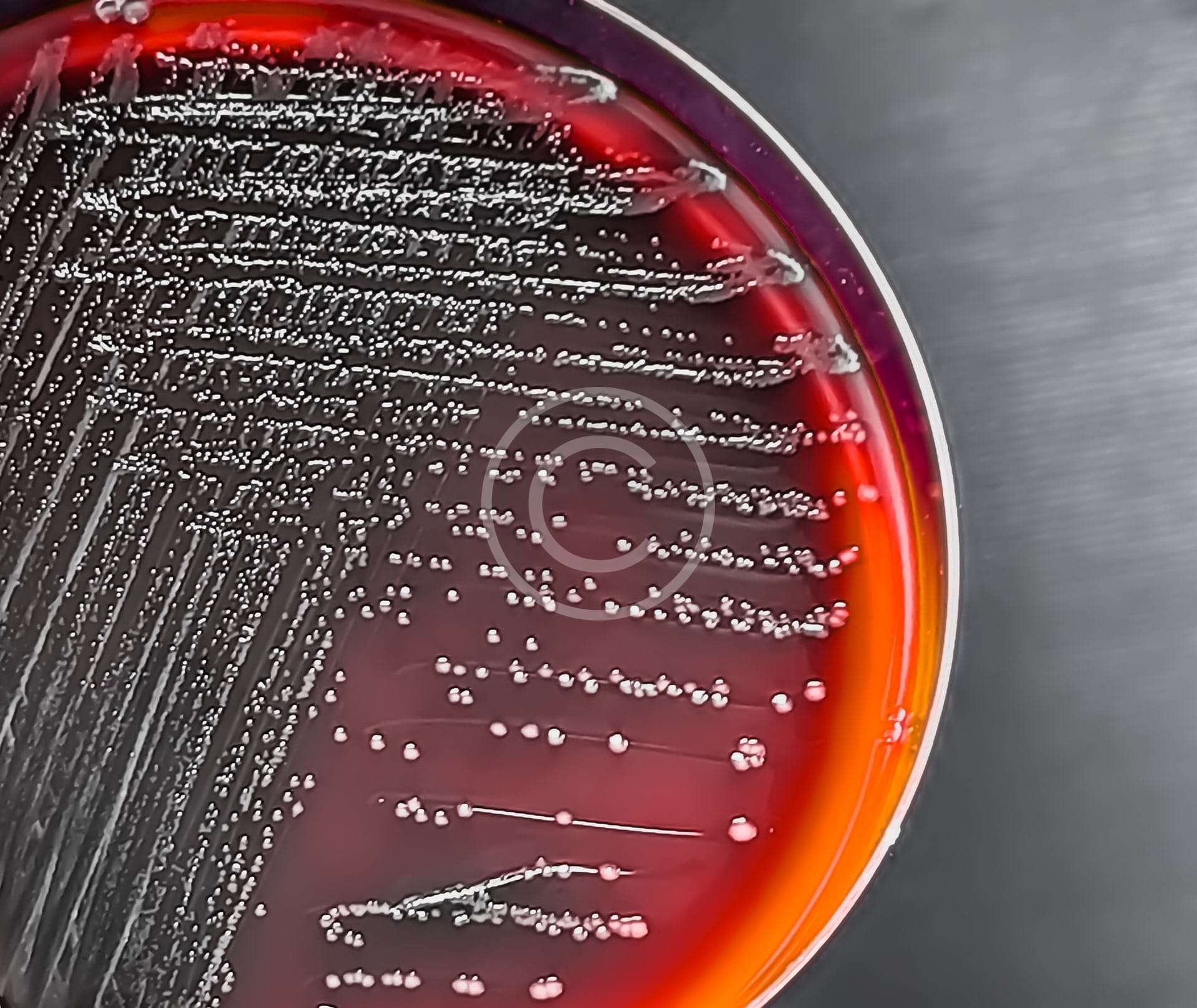 Cardiovascular Risk Profiling